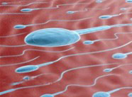 怎么治療尿路感染?